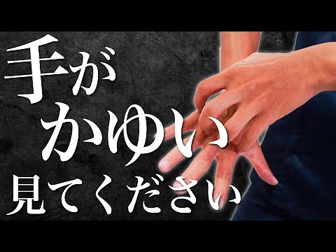 【手荒れ・アトピー】我慢できない手のかゆみを1日でも早く改善するセルフケア