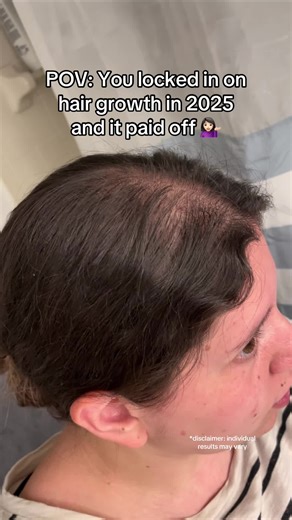 Boost Your Hair Growth with Scalp Care Tips