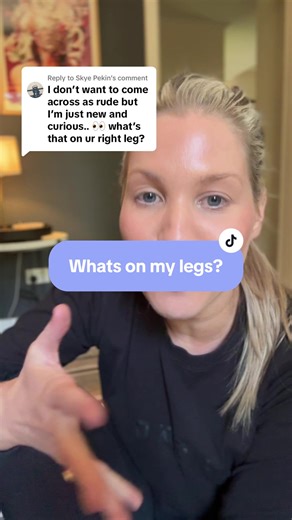 Understanding Psoriasis: My Journey with Biologic Injections