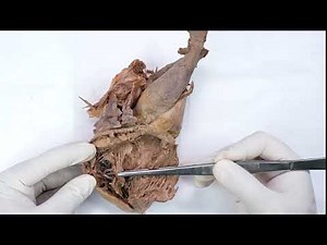 Interior of human heart - the chordae tendinae