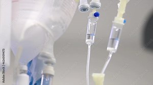 4K close-up footage of IV drip dropper in operating room during real surgery stock video.