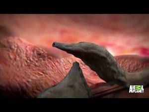 Worms Are Eating My Lungs