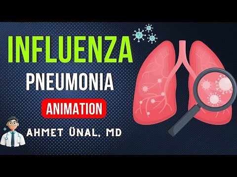 INFLUENZA (flu) VIRUS ANIMATION | PNEUMONIA