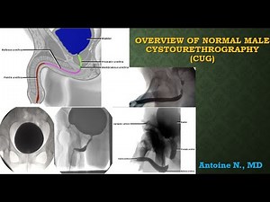 Normal male cystourethrography