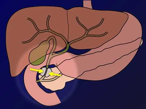 Untersuchungsablauf ERCP