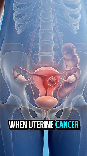 What Happens When You Need a Uterus Transplant?