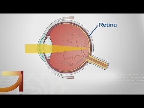 Good Question: How Do Glasses & Contacts Work?