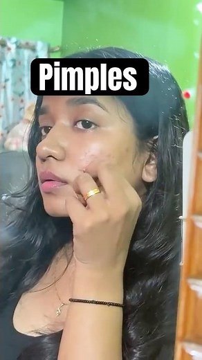 Best Pimple patch for face 😳 #viral #trending #reels #skincare #makeup #youtubeshorts #shorts #acne
