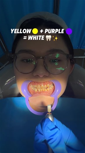 Effective Teeth Whitening Strategies for a Bright Smile