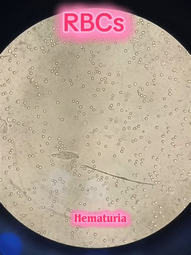 #viralvideo #unfrezzmyaccount #foryoupage #fyp #foryou