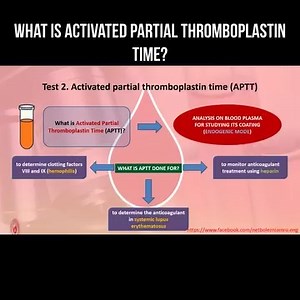 What is activated partial thromboplastin time? Coagulological test...