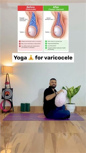 Yoga for Varicocele? Try These Gentle Poses