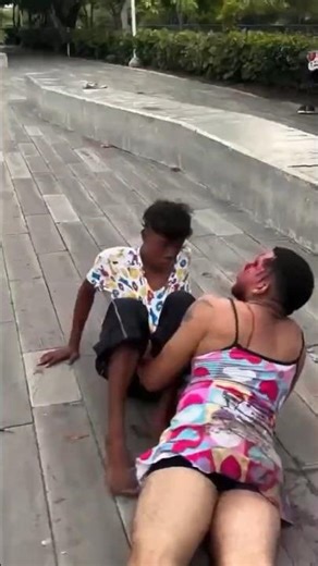 Funny Fake Arm Prank 😂 Unexpected Reaction!"