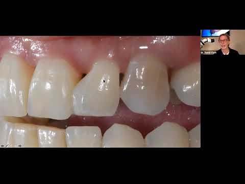 Bioclear Matrix | International Webinar Part 2