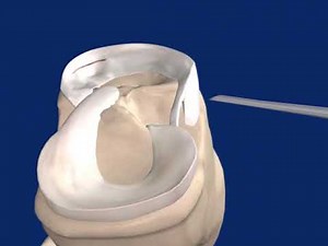 Fast Fix 360 Animation