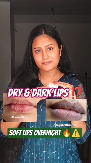 GET Pink Soft lips Overnight🔥⁉️#lips #pigmentation #shortviral #fypyoutube #viral #ytviral