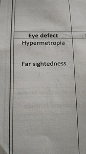 Eye defect HypermetropiaFar sightedness... | Filo