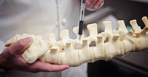 Artificial Disc Replacement (ADR) | Semmes Murphey Clinic