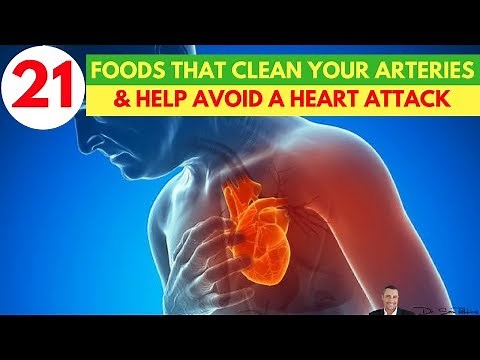 🍏🍉21 Foods That Are Clinically Proven To Clean Your Arteries & Help Avoid A Heart Attack or Stroke🍅🥑