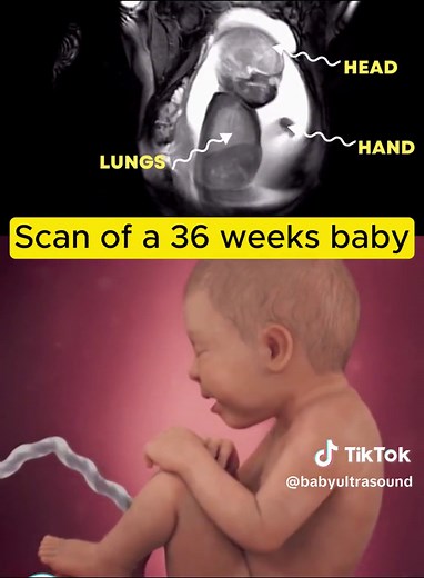 Baby Ultra Sound on TikTok