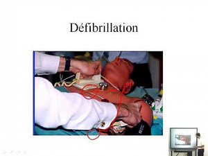 Dossier PAE - Cardiologie 07