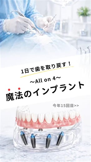 今年15回目のオールオン4のオペです！ #なかの歯科 #岡山歯医者 #インプラント治療 #オールオン4 #allon4