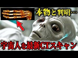 月の裏を見た宇宙飛行士…宇宙人ミイラを最新CTスキャン、解剖した結果…衝撃の中身が…NASAが隠蔽した宇宙人の真実【総集編・都市伝説・ロズウェル事件】