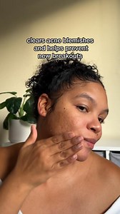 Stop acne in its tracks with this simple 2-step routine:​ ​ 💙 Step 1: cleanse away dirty and oil without over-drying ​ 💙 Step 2: clear acne blemishes while visibly reducing pores​ ​ #LaRochePosayUSA #LifeChangingDermatology #AcneProne #AcneRoutine | La Roche-Posay