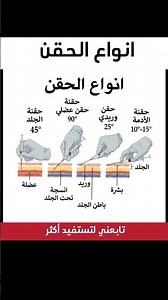 انواع الحقن