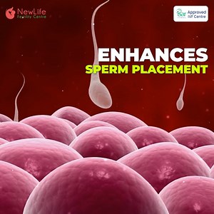 7.4K views · 206 reactions | Dreaming of parenthood? Intrauterine Insemination (IUI) might be your first step. It's safe, simple, and boosts your chances of conception with expert guidance every step of the way.   Call: +91 74074 00333 | +91 74074 00444  Visit us at: www.newlifefertilityclinic.com #IUI #NewLifeFertility #HopeToParenthood #FertilitySupport #ParenthoodJourney #NewBeginnings | NewLife Fertility Centre Siliguri | Facebook