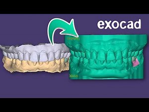 Implant MODEL Tutorial 2025 EXOCAD