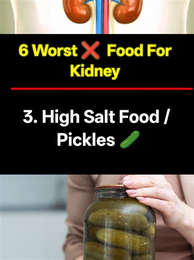 6 Foods That Can Harm Your Kidneys