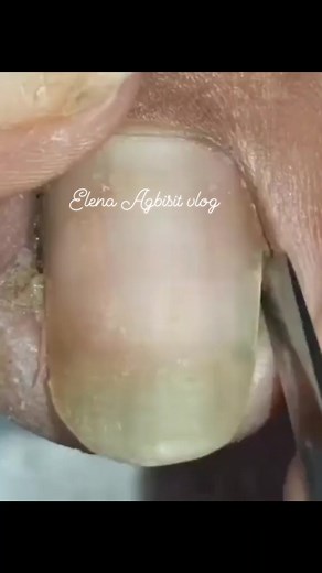 Dry skin #satisfying #reelsvideo #dryskin #pedicure #elenaagbisitvlog | Elena Agbisit Vlog