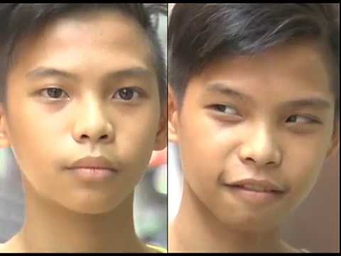 Operation Tuli, isinagawa ng GMA Kapuso Foundation