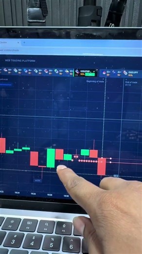 Binary Options Trading | Binary Options Trading | Quotex Trading Strategy #sureshot #shorts