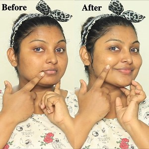 481K views · 5.9K reactions | Home Remedy de-tan Challenge! Before - After Live Video!! | Rose Beauty Tips | Facebook