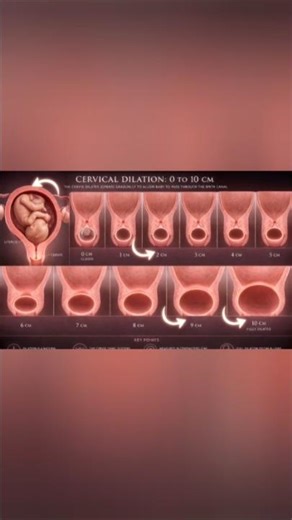 Cervix 0-10 cm