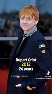 Rupert Grint ❤️ | Ron Weasley