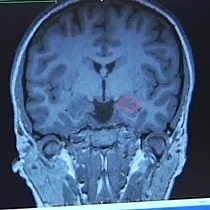 Video: Fear Conditioning- Classical Conditioning: Principle and Procedure