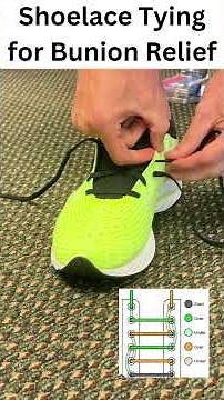 Shoelace Tying for Bunion Relief