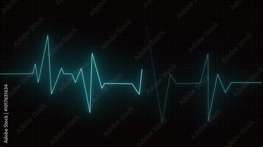 Heartbeat monitor animation A smooth animation in high quality on a heart rate monitor in a hospital environment