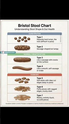 Bristol stool chart...