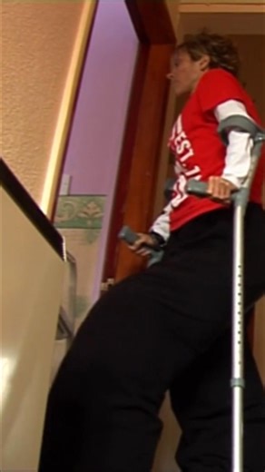 Born with a condition so rare that doctors don't understand why her legs won't stop growing, she faces unique challenges. But she refuses to let it stop her from living life to the fullest. She's a survivor, showing us all there are no excuses for not enjoying life. #RareCondition #Inspiration #Survivor #LivingFully #NoExcuses From: Losing One of my Giant Legs | Only Human