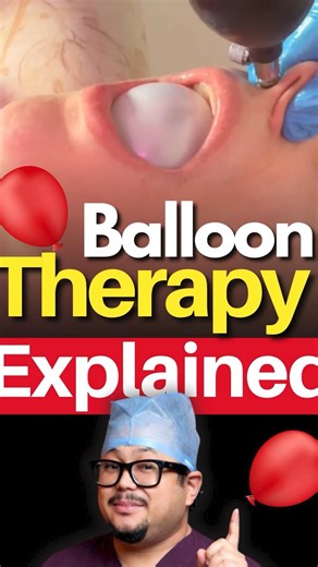 Cranial Facial Release Explained 👀 Does It Work?