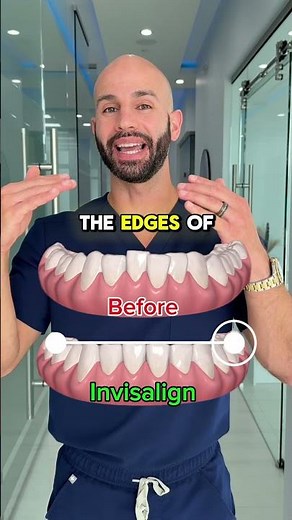 How to fix crooked lower teeth.