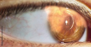 Closeup eye with reflection nuclear explosion and fire. Macro shot on RED 4K. Stock Video