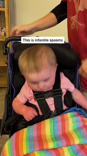 Understanding Infantile Spasms and Epilepsy in Children