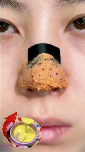 Remove Blackheads & Whiteheads Fast 👃✨ Get cleaner pores and smoother looking skin naturally 🧖‍♀️�