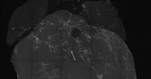 What Happens When We Pass Out? Researchers ID New Brain and Heart Connections