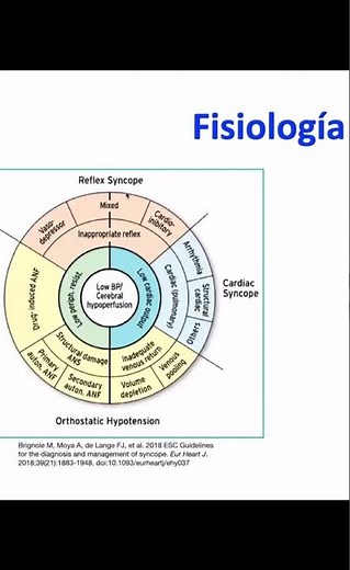 ¿Qué es el síncope reflejo y cómo se clasifica según las guías médicas?. Dr. César Bretón